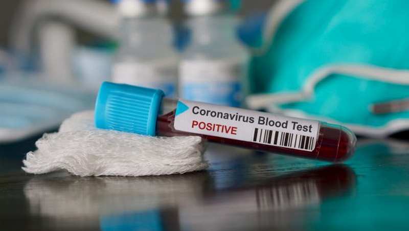 coronavirus test